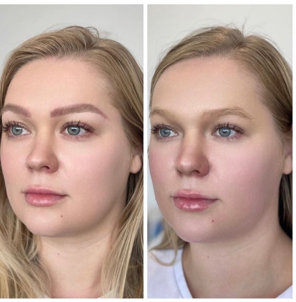 Before and After Brow Feathering